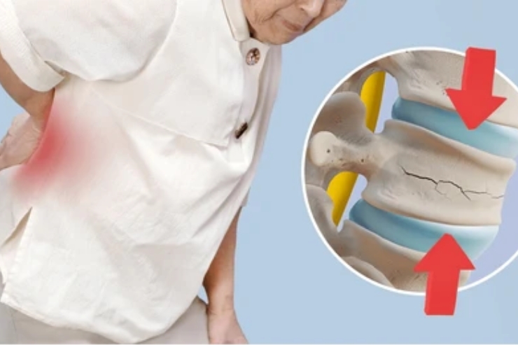 Traumatic Spine Fracture Surgeries